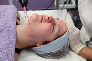 Entspannt zum Hautarzt: So setzen Sie Laserbehandlungen clever von der Steuer ab! entspannt-zum-hautarzt-so-setzen-sie-laserbehandlungen-clever-von-der-steuer-ab