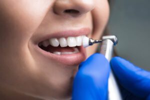 zahnreinigung-von-der-steuer-absetzen-so-sparen-sie-clever-und-gesund